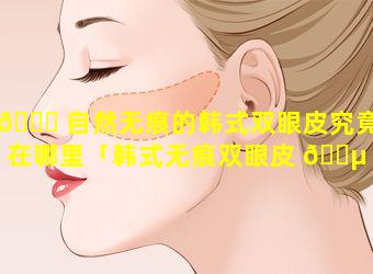 🐒 自然无痕的韩式双眼皮究竟好在哪里「韩式无痕双眼皮 🐵 一般需要多少钱」